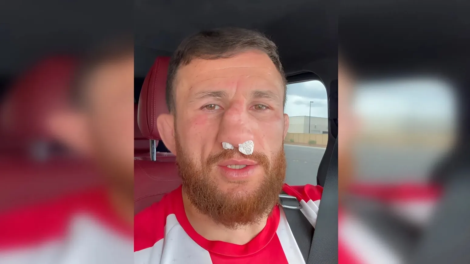 Двалишвили сломал нос в двух местах, но отказался от операции: в чем причина фото на sportnews.kz от 03 апреля 2026 14:38